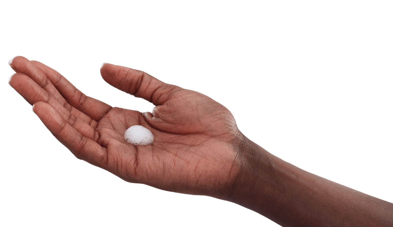 Hand with a small amount of ZORYVE topical foam